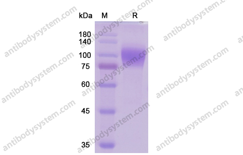 Recombinant Human CD146/MCAM Protein, C-His