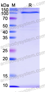 Recombinant Human NOTCH1 Protein, C-Fc