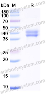 Recombinant Human CD151 Protein, N-Fc