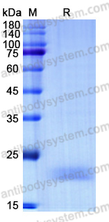 Recombinant Human Flt3 ligand/FLT3LG Protein, C-His