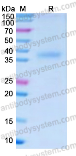 Recombinant Human CD296/ART1 Protein, C-His