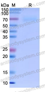 Recombinant Human CD85g/LILRA4 Protein, C-His