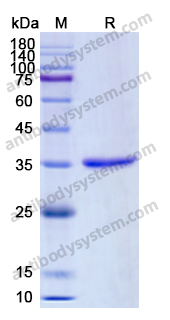 Recombinant Human CD81 Protein, N-Fc