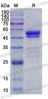 Recombinant Human SRP54 Protein, N-His