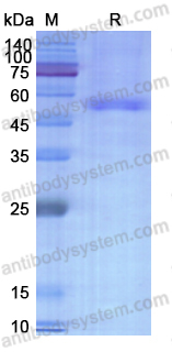 Recombinant Human PIP4K2B/PIP4KII-beta Protein, N-His