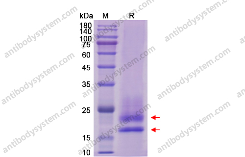 Recombinant Human CD83 Protein, C-His