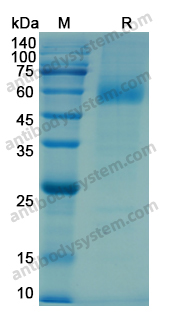 Recombinant Human IL1RL1/ST2 Protein, C-His