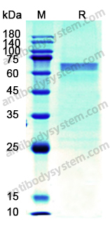 Recombinant Human DSG1 Protein, C-His