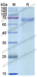 Recombinant Human DSG1 Protein, C-His