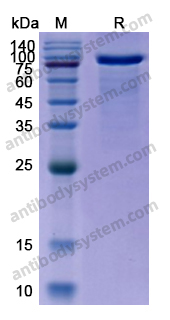 Recombinant Human NOTCH2 Protein, C-Fc