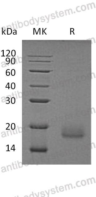 Recombinant Human ACVR1 Protein, C-His