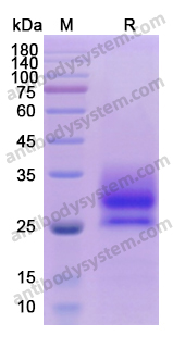 Recombinant Human CD137/TNFRSF9 Protein, C-His