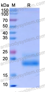 Recombinant Human CD69 Protein, C-His