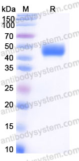 Recombinant Human CDw210b/IL10RB Protein, C-His