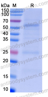 Recombinant Human CD167a/DDR1 Protein, C-His