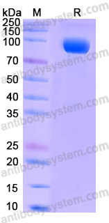 Recombinant Human SIGLEC14 Protein, C-Fc