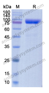 Recombinant Human FAP Protein, C-His