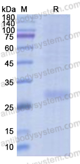 Recombinant Human CD161/KLRB1 Protein, C-His