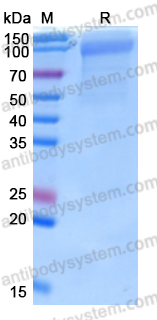 Recombinant Human PTK7/CCK-4 Protein, C-His