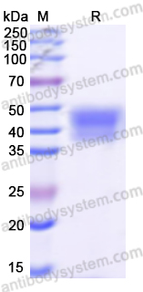 Recombinant Human MSLN/Mesothelin Protein, C-His