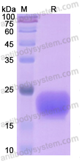 Recombinant Human WFDC2/WAP5 Protein, C-His