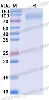 Recombinant Human GPNMB Protein, C-His