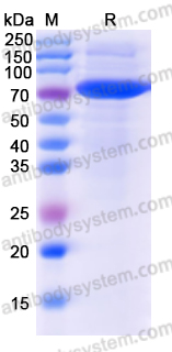 Recombinant Human POSTN/OSF-2 Protein, C-His