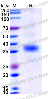 Recombinant Human TPSAB1/Tryptase-1 Protein, C-His