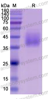 Recombinant Human CD226/DNAM-1 Protein, C-His