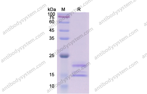 Recombinant Human IL17A Protein, C-His