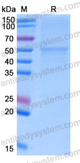 Recombinant Human CA9 Protein, C-His