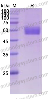 Recombinant Human CD167b/DDR2 Protein, C-His