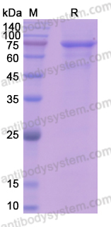 Recombinant Human TXNRD1 Protein, C-His