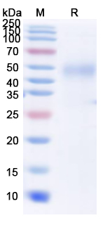 Recombinant Human MICB*008 Protein, C-His