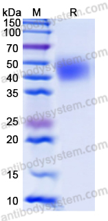 Recombinant Human MICA Protein, C-His