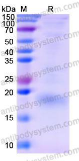 Recombinant Human TIGIT Protein, C-His