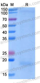 Recombinant Human IL31 Protein, C-His