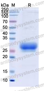 Recombinant Human CD305/LAIR1 Protein, C-His