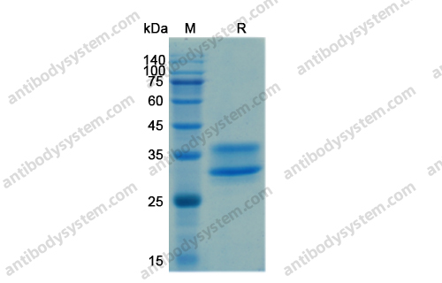 Recombinant Human IL34 Protein, C-His