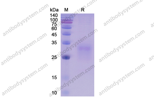 Recombinant Human CD272/BTLA Protein, C-His