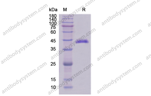 Recombinant Human CD165/ADAMTSL1 Protein, C-His