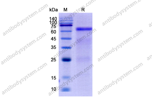 Recombinant Human GOLM1/GP73 Protein, C-His