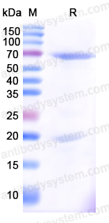 Recombinant Human PCSK9 Protein, C-His