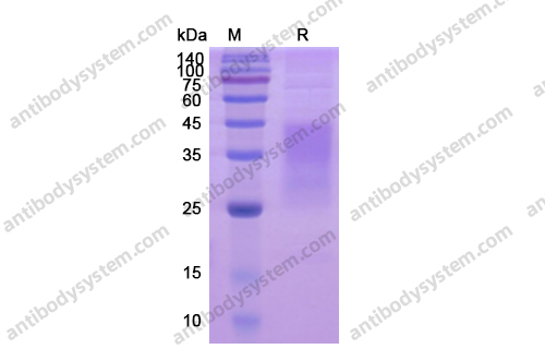 Recombinant Human CD366/HAVCR2/TIM-3 Protein, C-His