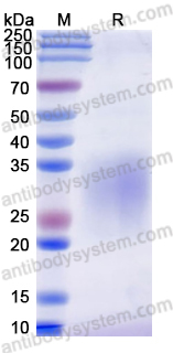 Recombinant Human CD300f/CD300LF Protein, C-His