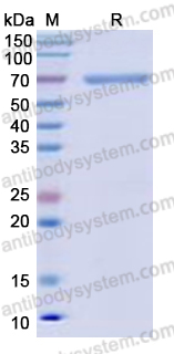 Recombinant Human CD316/IGSF8 Protein, C-His