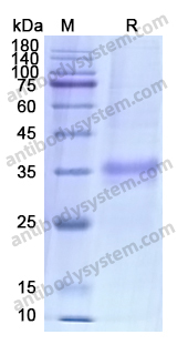 Recombinant Human RGMA Protein, C-His
