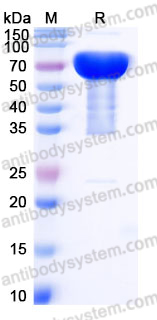 Recombinant Human CD352/SLAMF6 Protein, C-Fc
