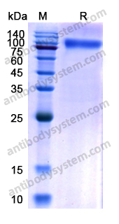 Recombinant Human CD217/IL17RA Protein, C-Fc