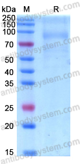 Recombinant Human LINGO1 Protein, C-His